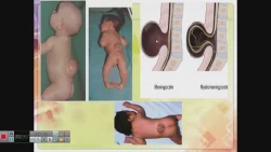 ویدیو 2 مرضیه غلامی